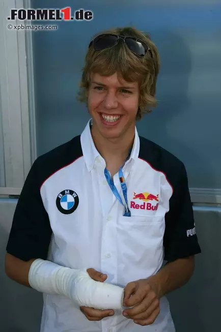 Gebrochener Finger nach einem Rennunfall in der Renault-World-Series in Spa-Francorchamps 2006. Foto zur News: Gebrochener Finger nach einem Rennunfall in der Renault-World-Series in Spa-Francorchamps 2006.