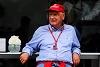 Foto zur News: Niki Lauda: Darum kann ich mit meiner Entstellung gut leben